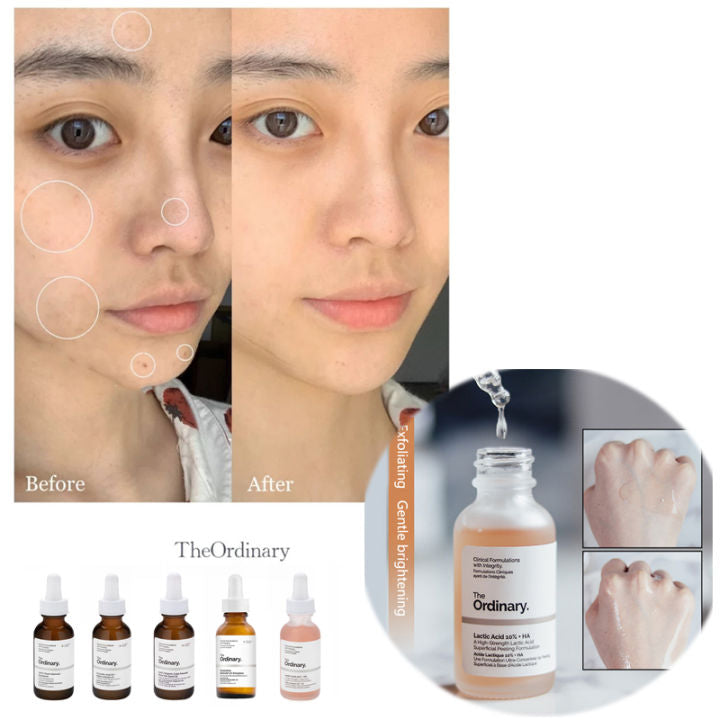 Direct Acids Lactic Acid 5% + HA 30 ml