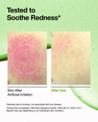 Anua Azelaic Acid 10 + Hyaluron Redness Soothing Serum 30ml