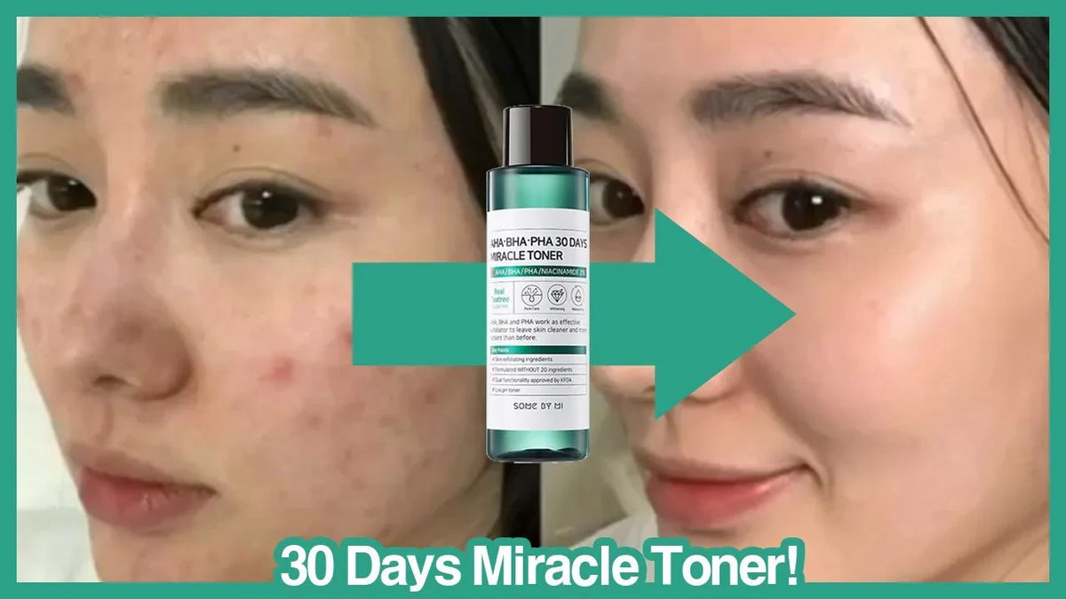 SOME BY MI AHA BHA PHA 30 Days Miracle Toner 150 ml