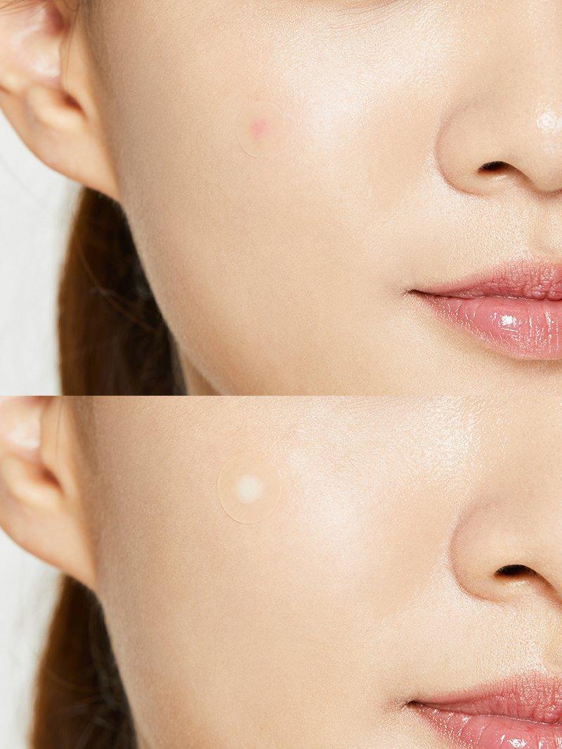 Cosrx Acne Pimple Master Patch 24 ea.