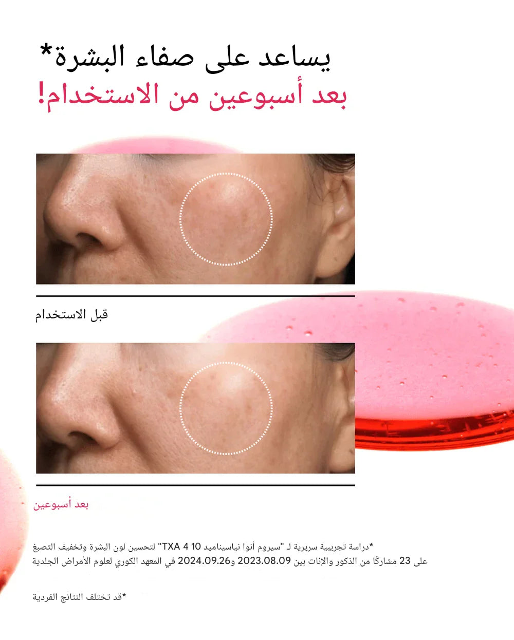 Anua Niacinamide 10% + Txa 4% Serum 30ml
