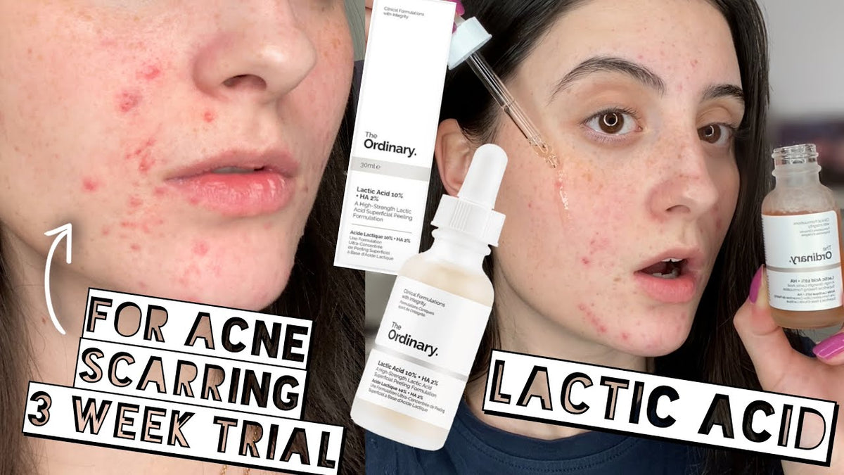Direct Acids Lactic Acid 5% + HA 30 ml