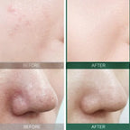 SOME BY MI AHA BHA PHA 30 Days Miracle Starter Kit